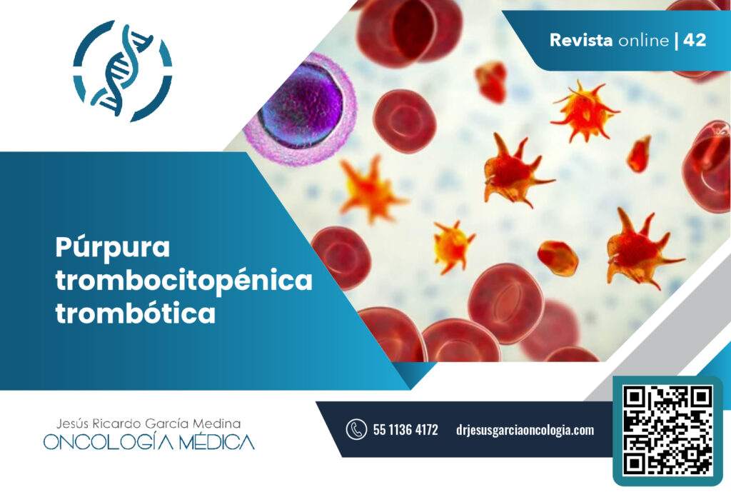 Púrpura Trombocitopénica Trombótica - Dr. Jesús Ricardo García Medina